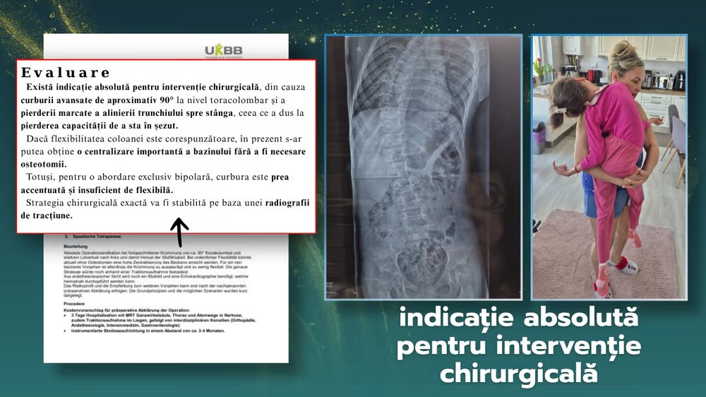 Fragment din raportul medical, radiografia și mama ținând-o pe Sofia în brațe